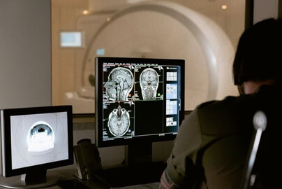 MRI Brain Imaging Identifies Regions Responsive to Fatty Foods